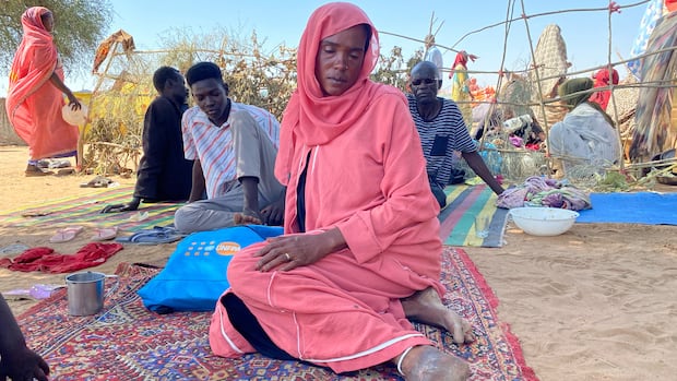 Sudanese who fled el-Fasher city, after Sudan's paramilitary forces killed hundreds of people in the western Darfur region, gather at their camp in Tawila, Sudan, Thursday, Oct. 30, 2025. (AP Photo/Mohammed Abaker) A woman sits on the ground with her injured foot extended, surrounded by others.